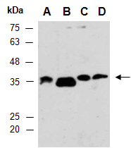 ZDHHC7 Antibody Western (Abiocode)