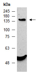 ROBO3 Antibody Western (Abiocode)