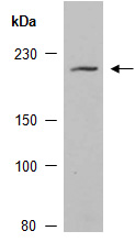KDM5D JARID1D Antibody Western (Abiocode)