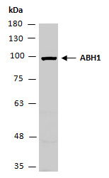 ABH1 Antibody Western (Abiocode)