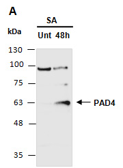 PAD4 Antibody Western (Abiocode)