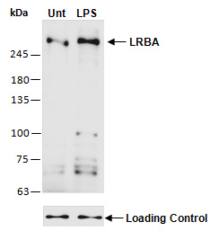 LRBA Antibody Western (Abiocode)