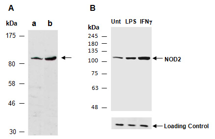 NOD2 Antibody Western (Abiocode)