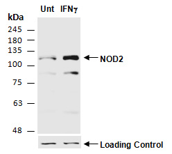 NOD2 Antibody Western (Abiocode)