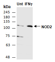 NOD2 Antibody Western (Abiocode)
