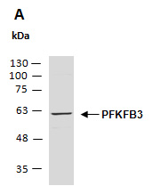 PFKFB3 Antibody Western (Abiocode)
