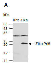 Zika Virus Pr PrM Protein Antibody Western (Abiocode)