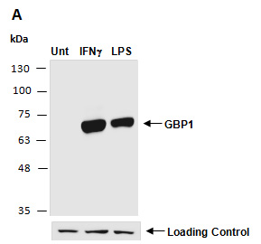 GBP1/GBP-1 Antibody Western (Abiocode)